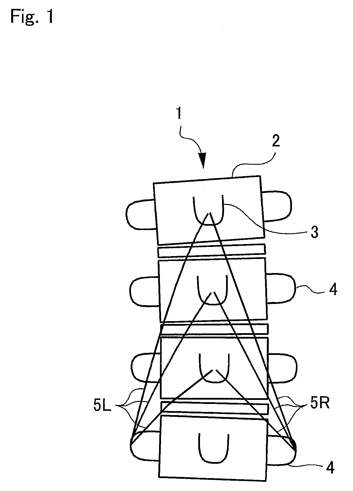 Spinal correction device