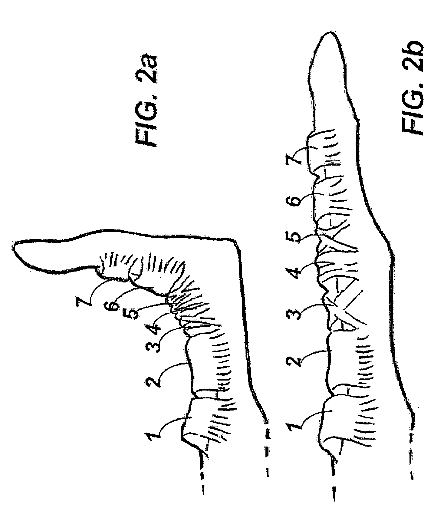 Device and method for assisting in flexor tendon repair and rehabilitation