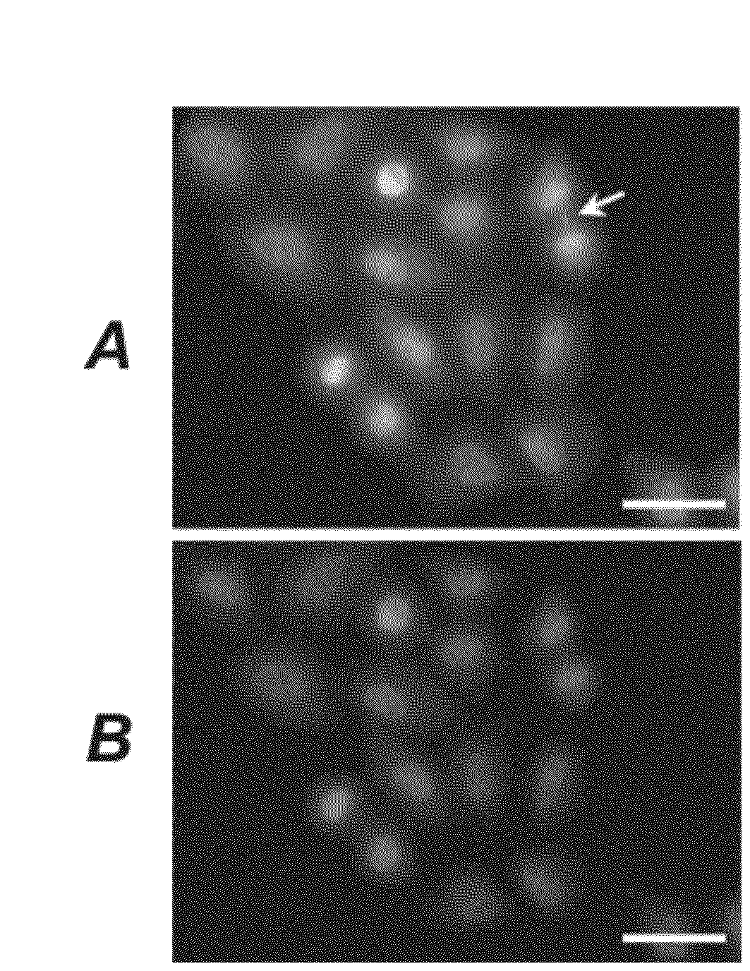 Methods and compositions for targeting polyubiquitin