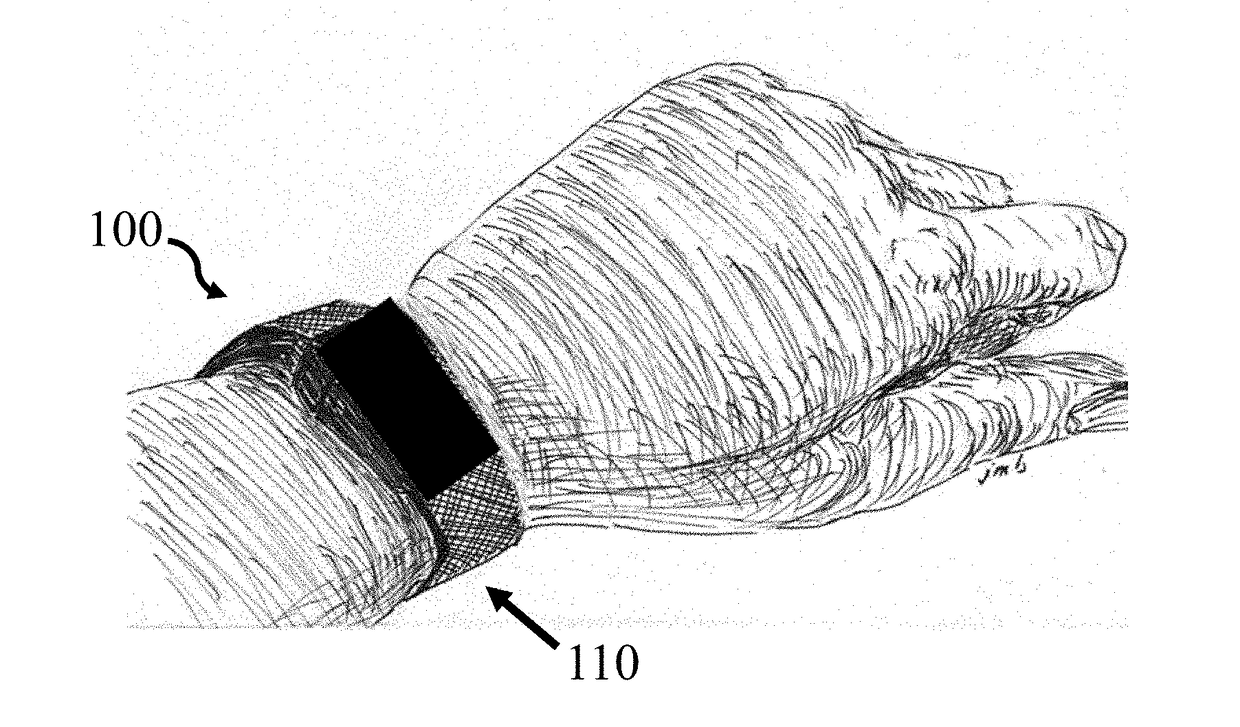 Wearable monitoring device