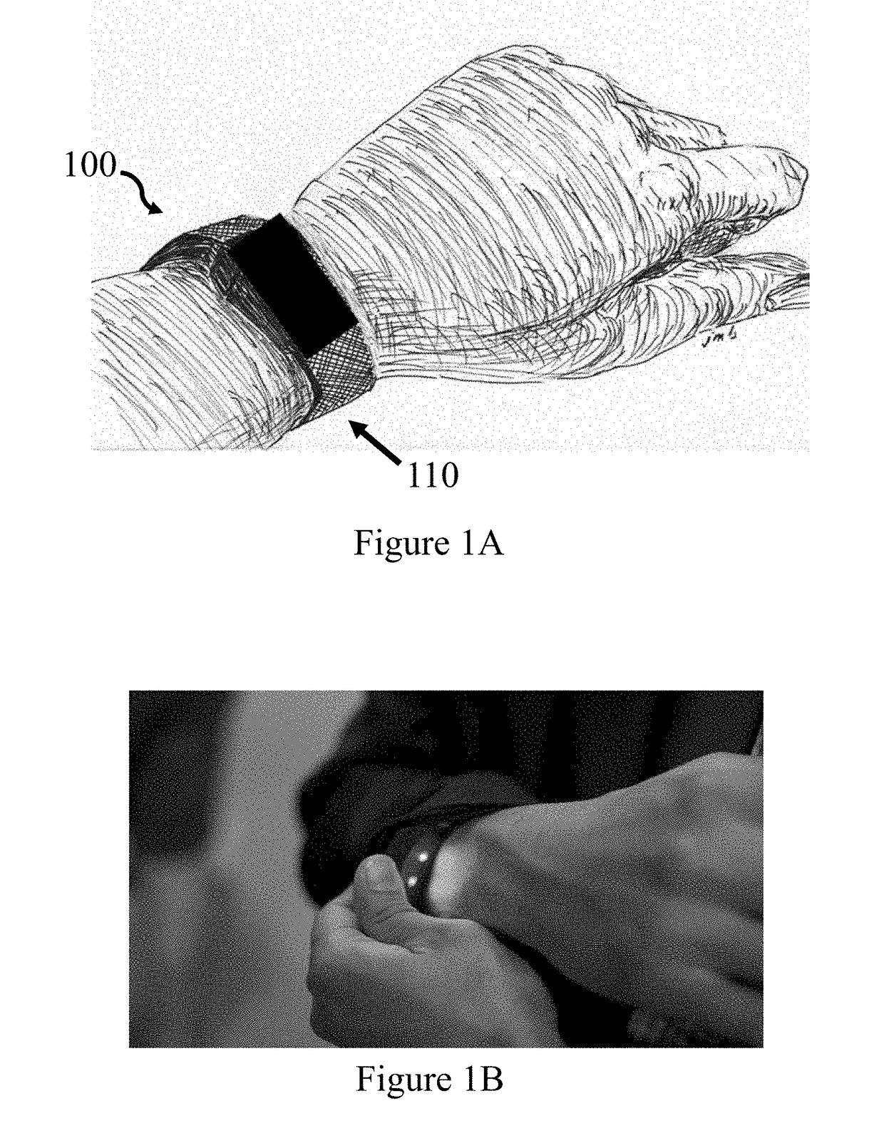Wearable monitoring device