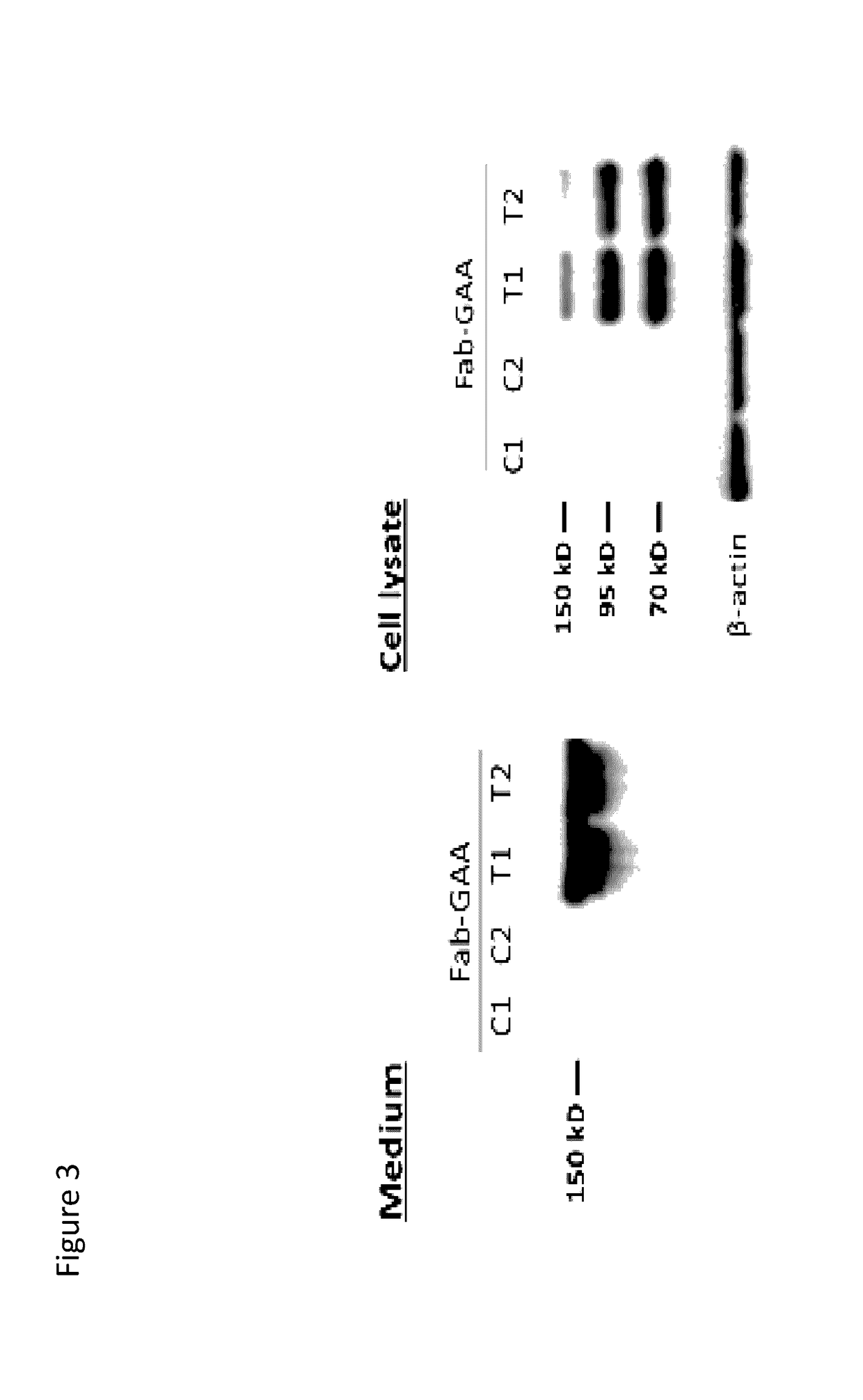 Methods and compositions for treatment of glycogen storage diseases and glycogen metabolism disorders