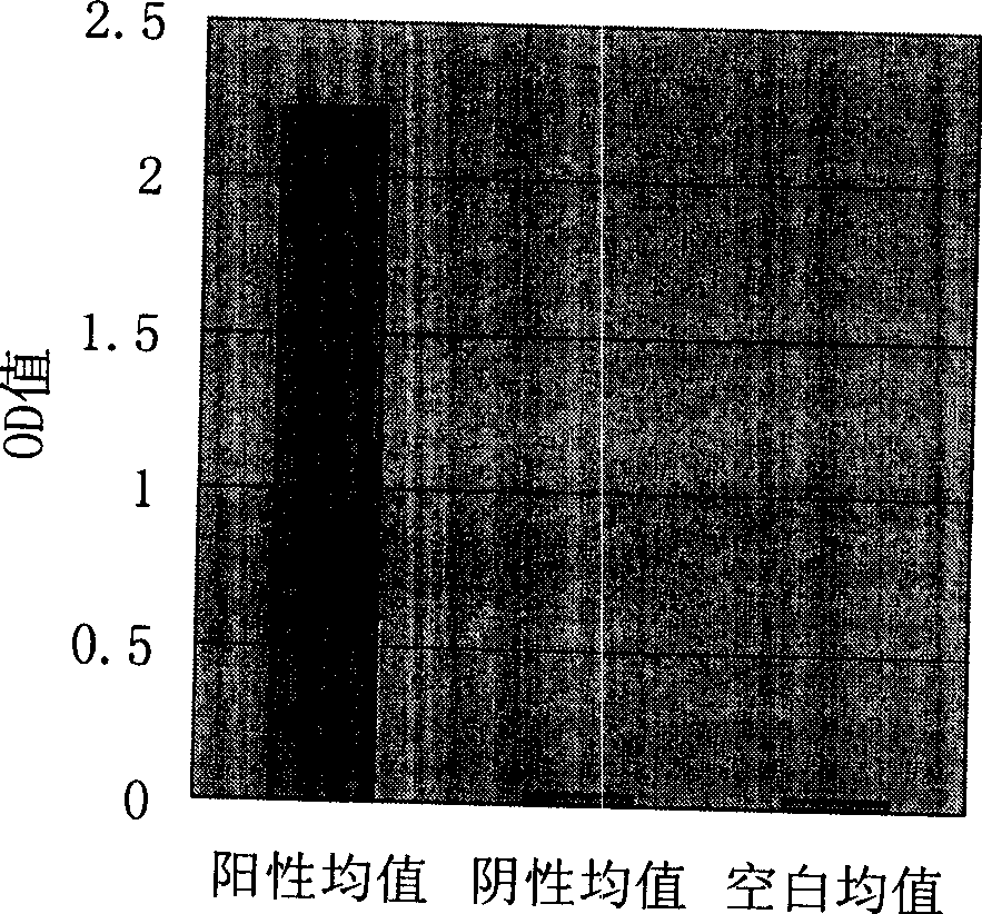 Method for detecting double-chain DNA resistant antibody using gold magnetic particle as carrier