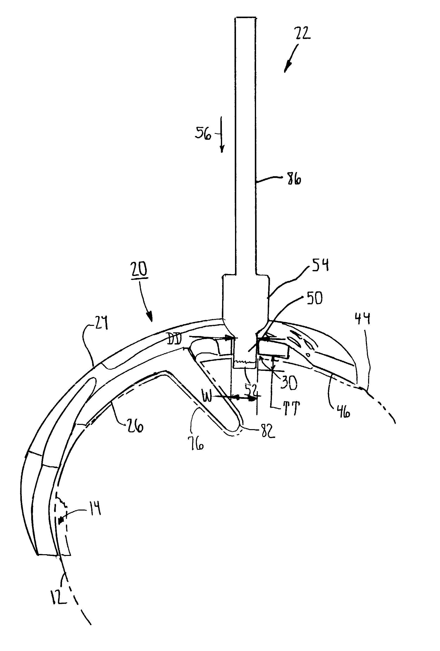 Prosthesis cutting guide, cutting tool and method