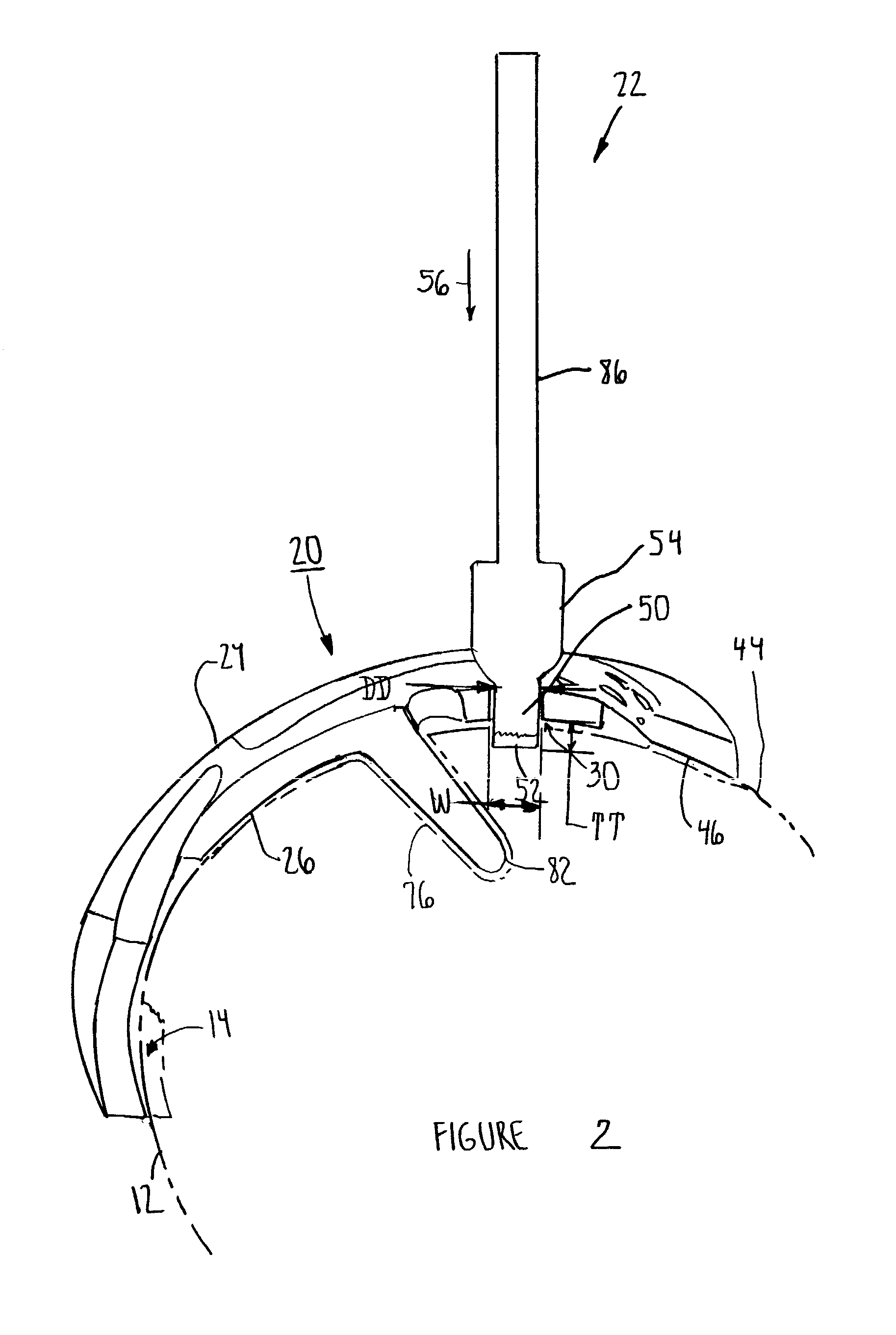 Prosthesis cutting guide, cutting tool and method