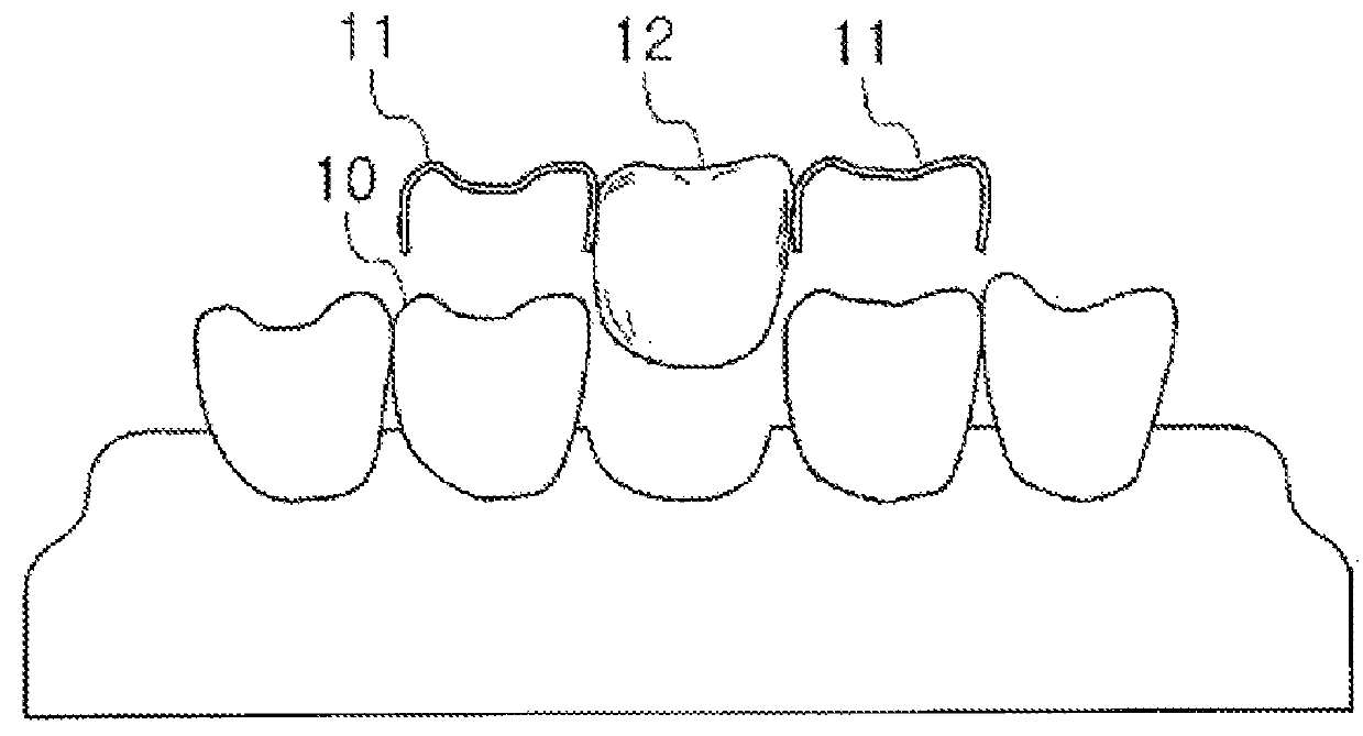 Dental prosthesis and manufacturing method thereof
