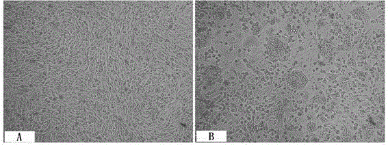 Porcine pseudorabies virus strain and application thereof