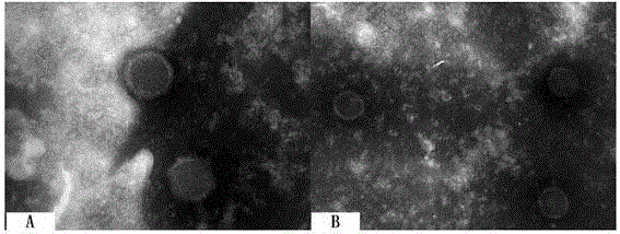 Porcine pseudorabies virus strain and application thereof