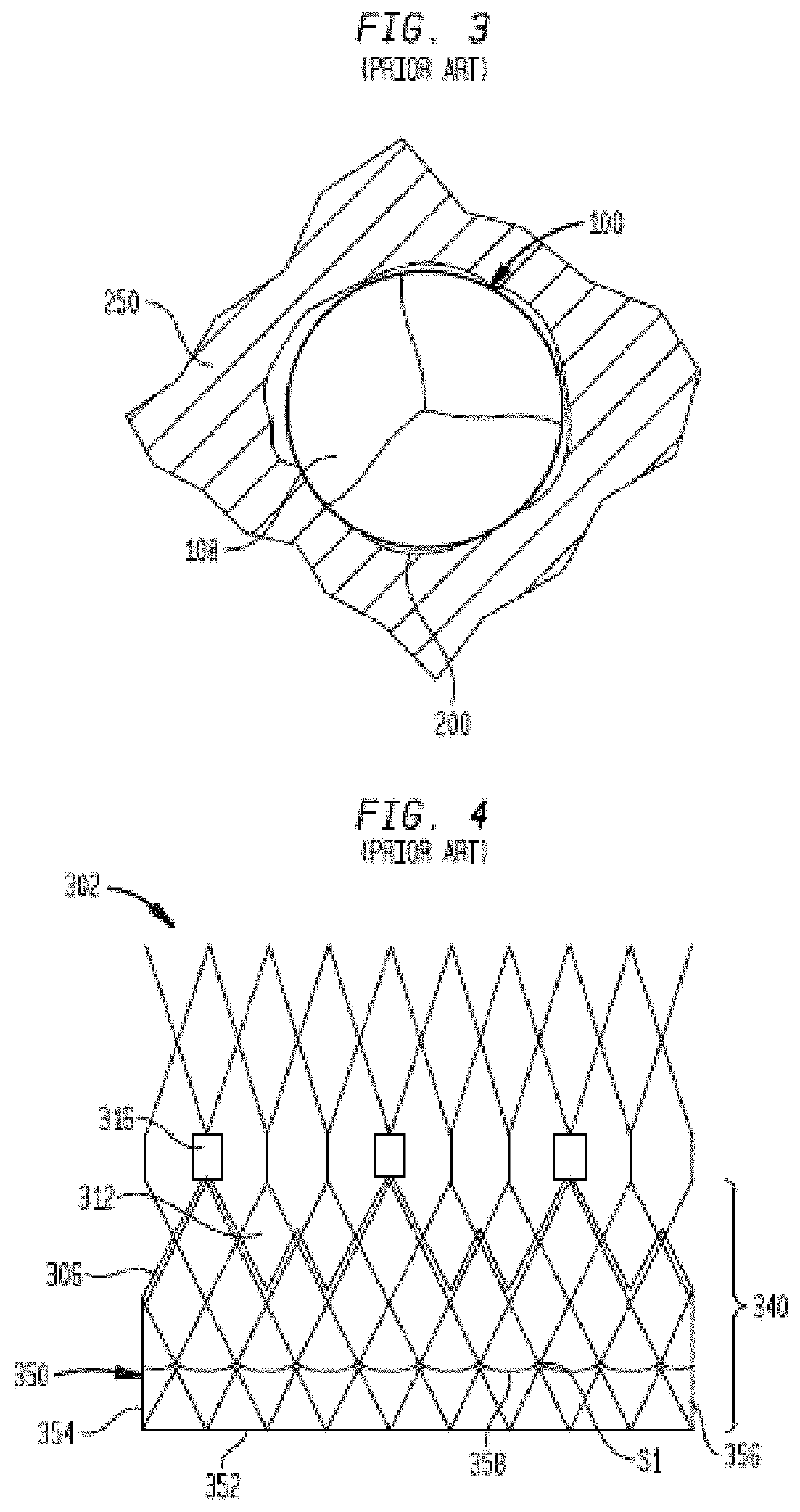 Sheet material for medical devices