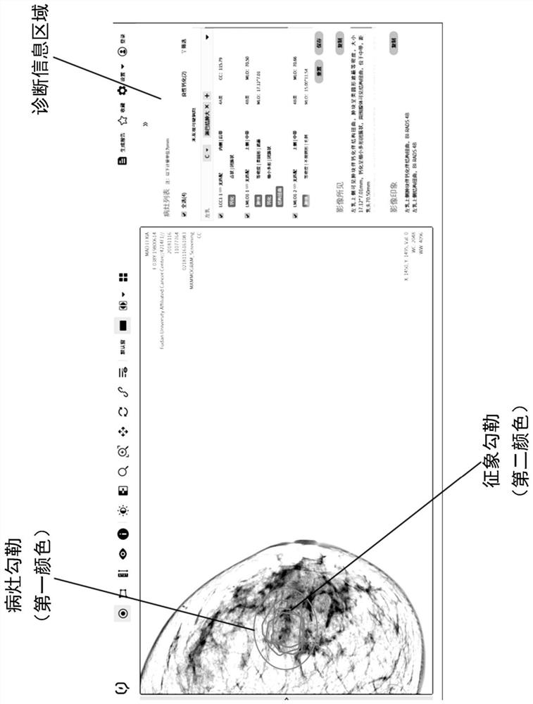 Display method, interaction method and storage medium of medical image