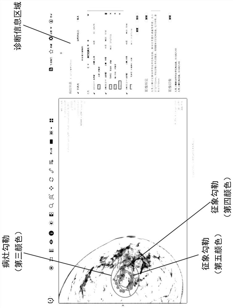 Display method, interaction method and storage medium of medical image