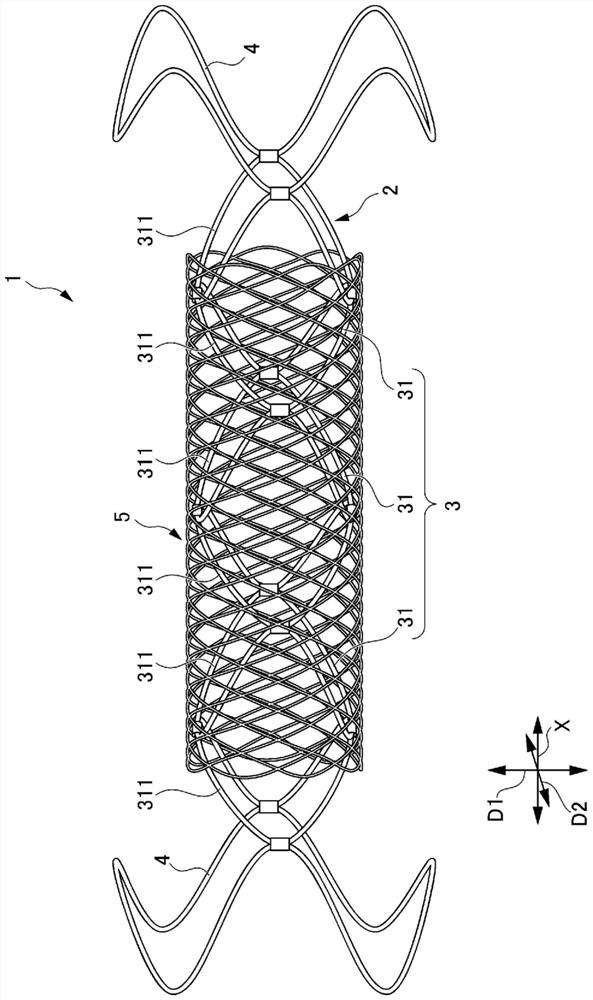 Synthetic resin stent and stent delivery system