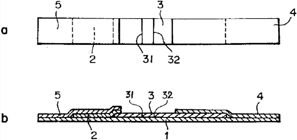 Immunological detection method and kit for mycoplasma pneumoniae