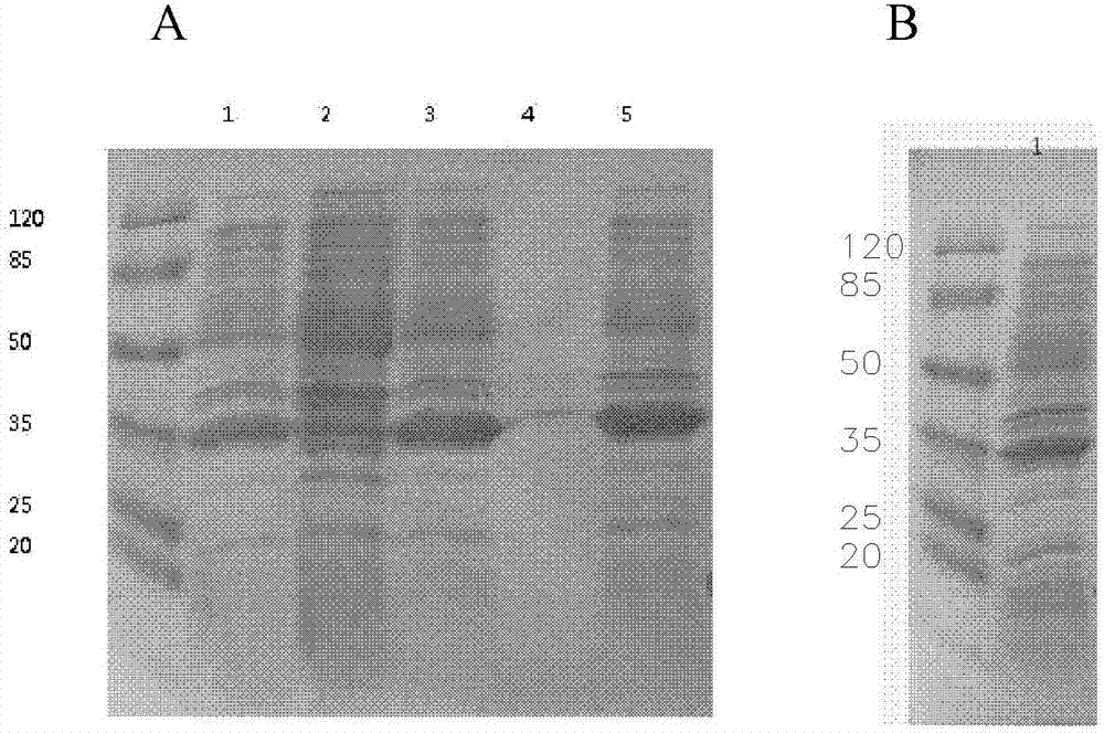 Human NT-proBNP preparation capable of stable preservation and preparation method thereof