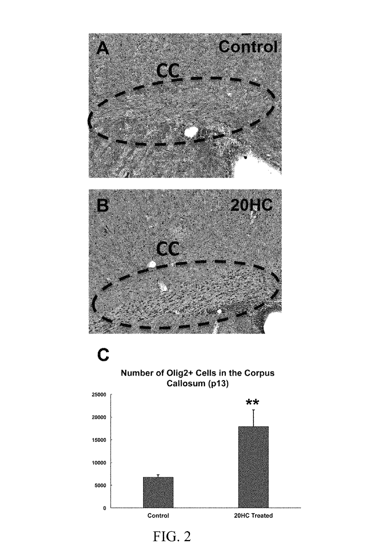Compositions and methods for the repair of myelin
