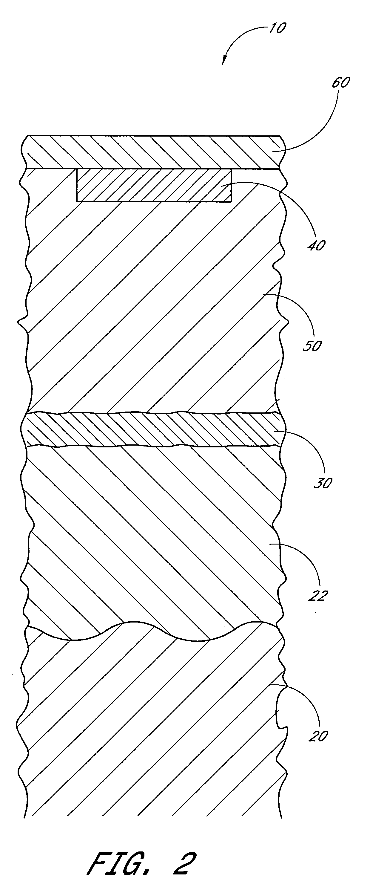 Device and method for providing phototheraphy to the brain