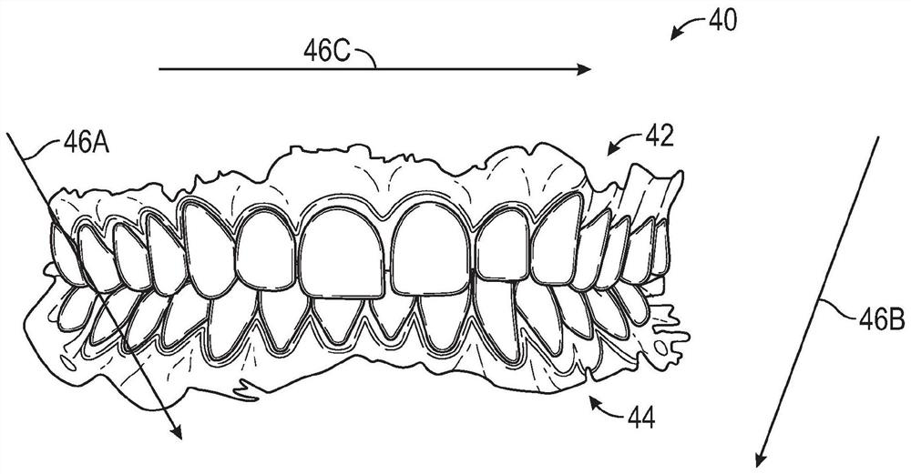 Virtual joint motion model for dental processing