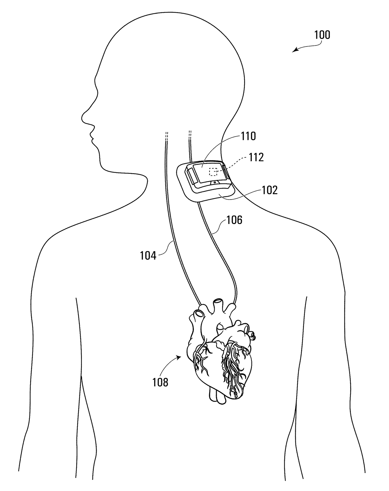 Systems and methods for automated fluid response measurement