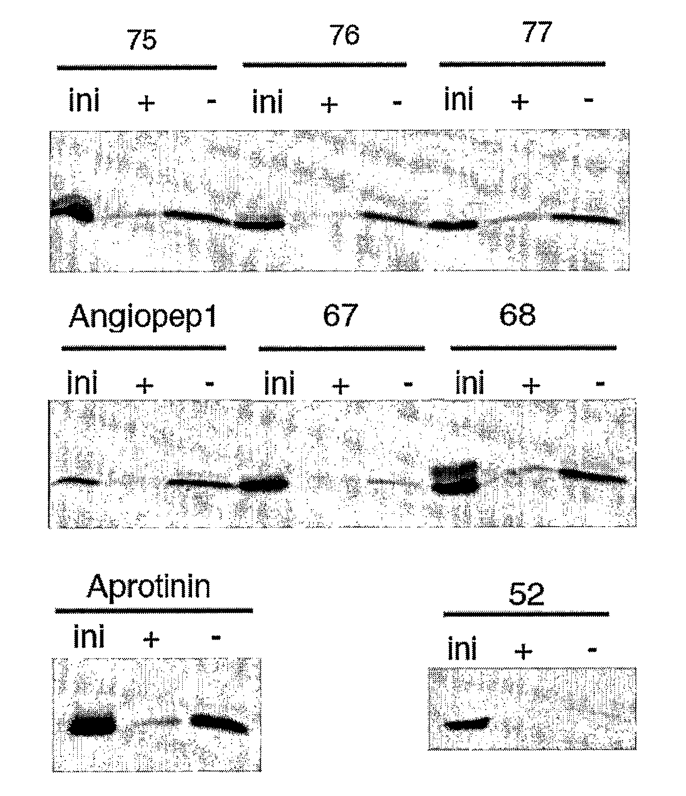 Aprotinin Polypeptides for Transporting a Compound Across the Blood-Brain Barrier