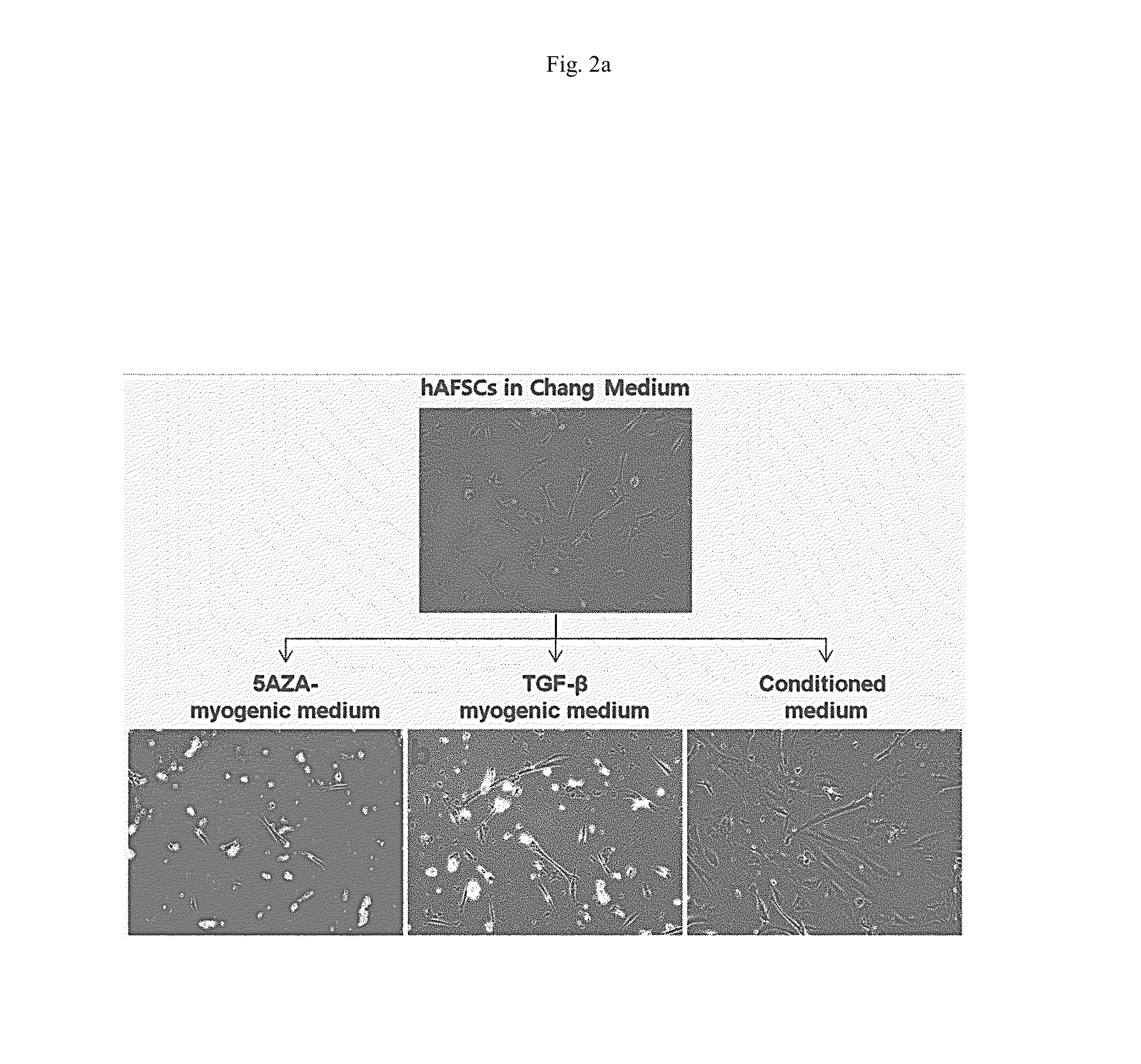 Agent for treating urinary incontinence including stem cells derived from amniotic fluid