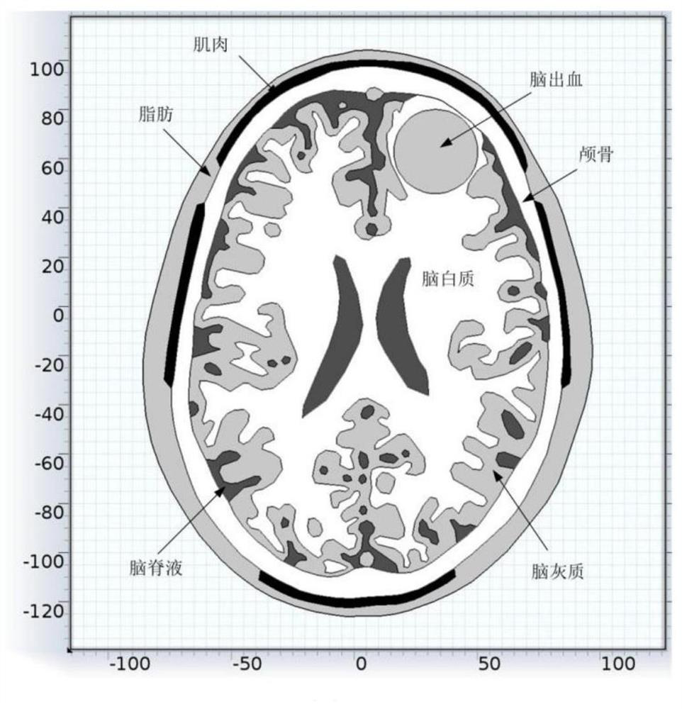 A multi-frequency electromagnetic tomography method for the detection of intracerebral hemorrhage