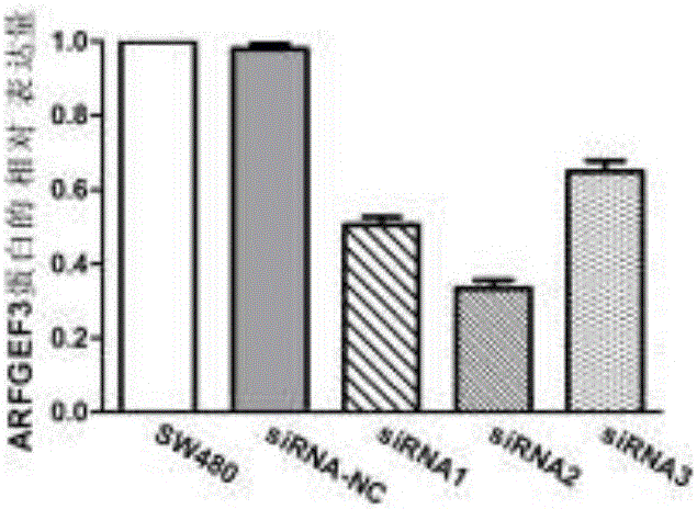 Application of gene used as biomarker in colon adenocarcinoma