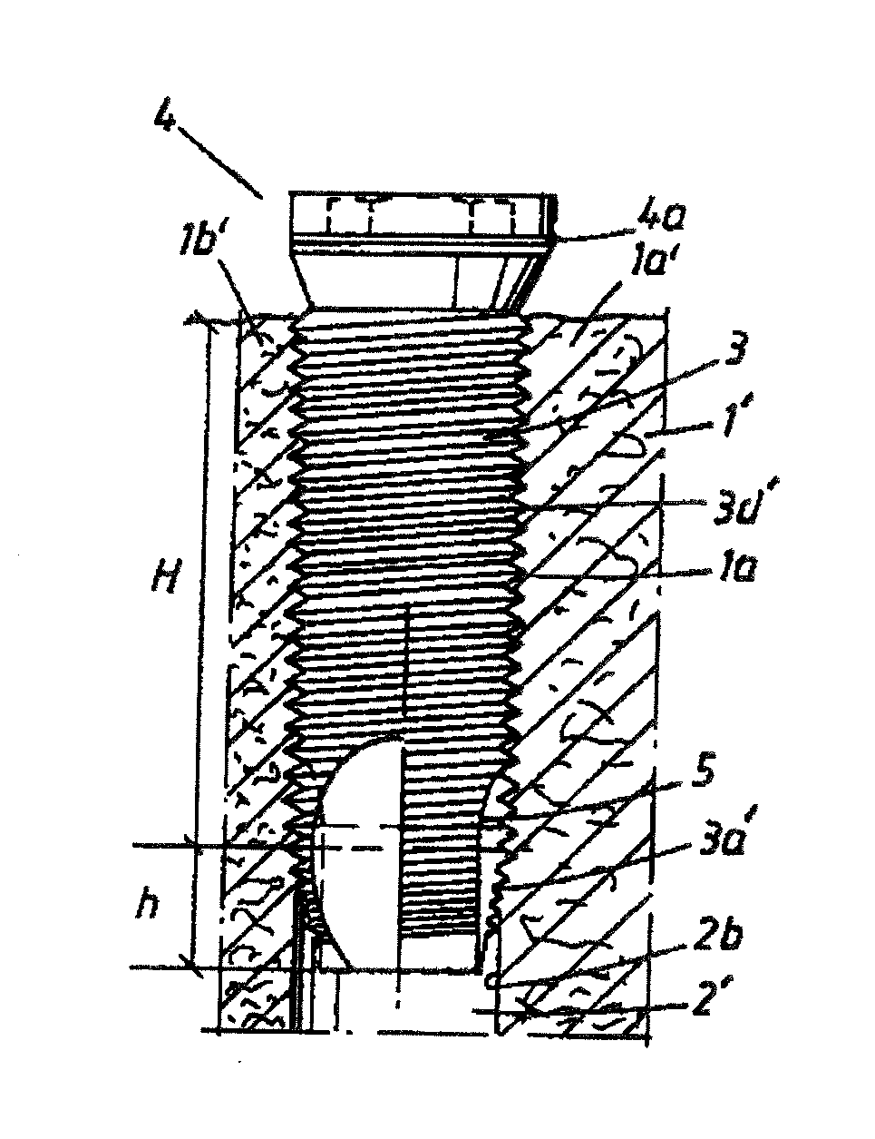 Arrangement for Obtaining Reliable Anchoring of a Threaded Implant in a Bone