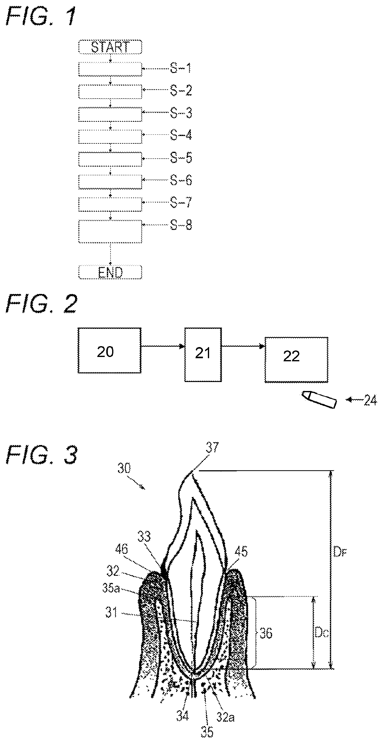 Method for periodontal disease measurement