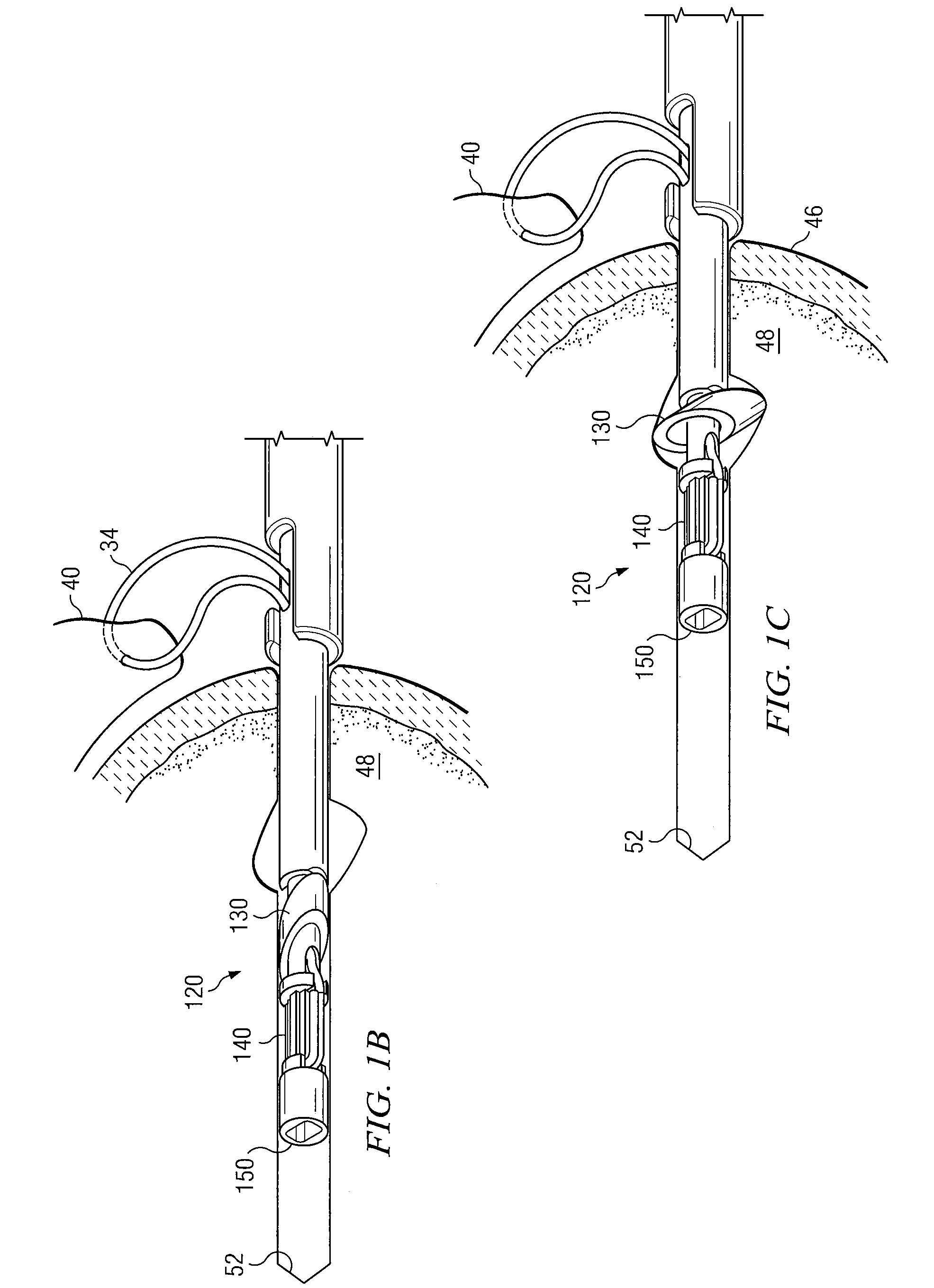 Knotless suture anchor having discrete polymer components and related methods