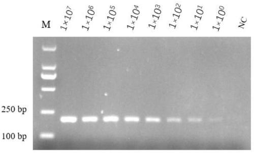 Specific gene of Acinetobacter baumannii and primer and application thereof