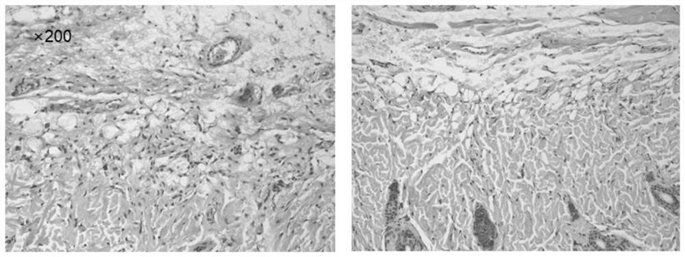 A preparation for the treatment of contact dermatitis