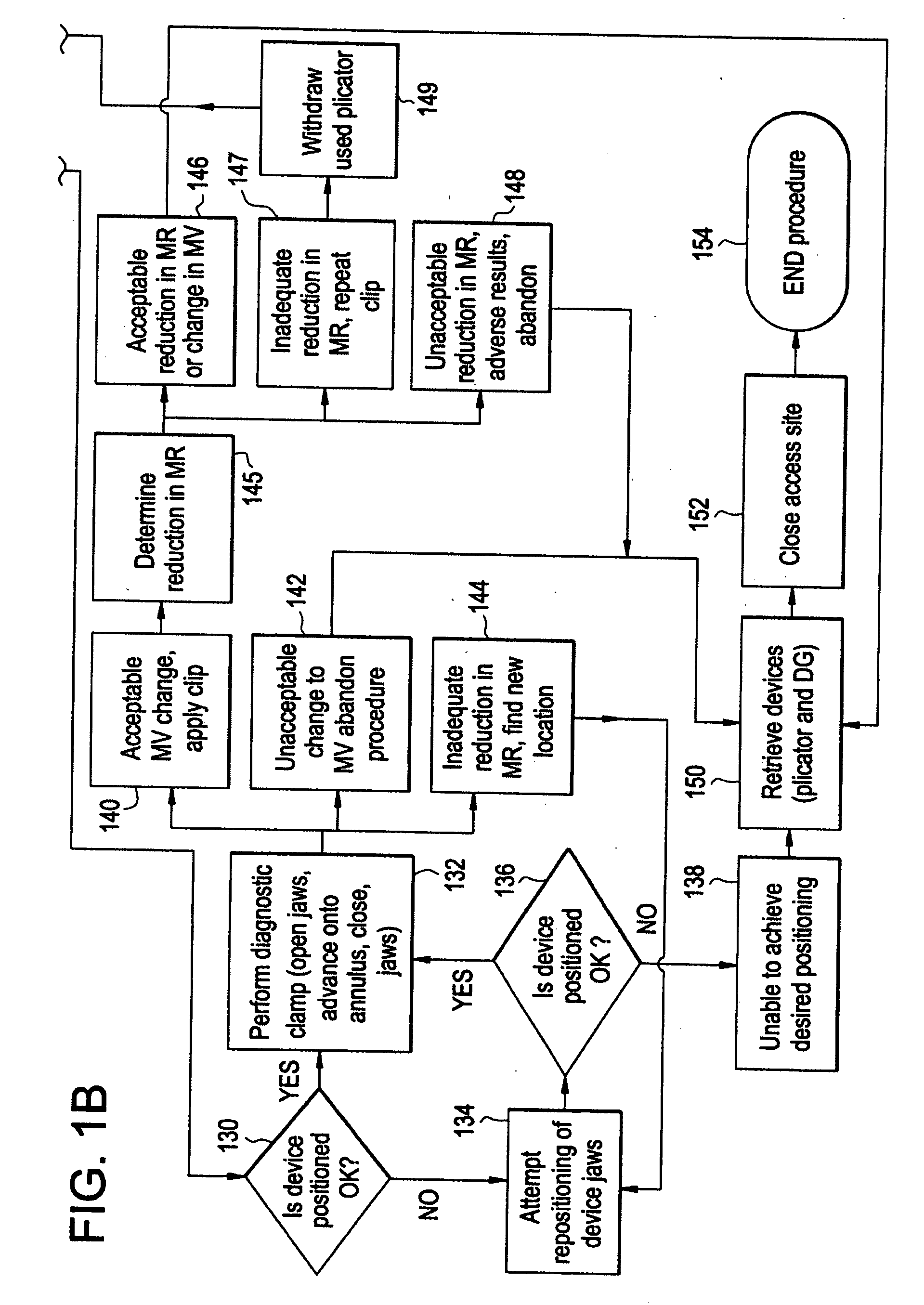 Method and system for plicating tissue in a minimally invasive medical procedure for the treatment of mitral valve regurgitation