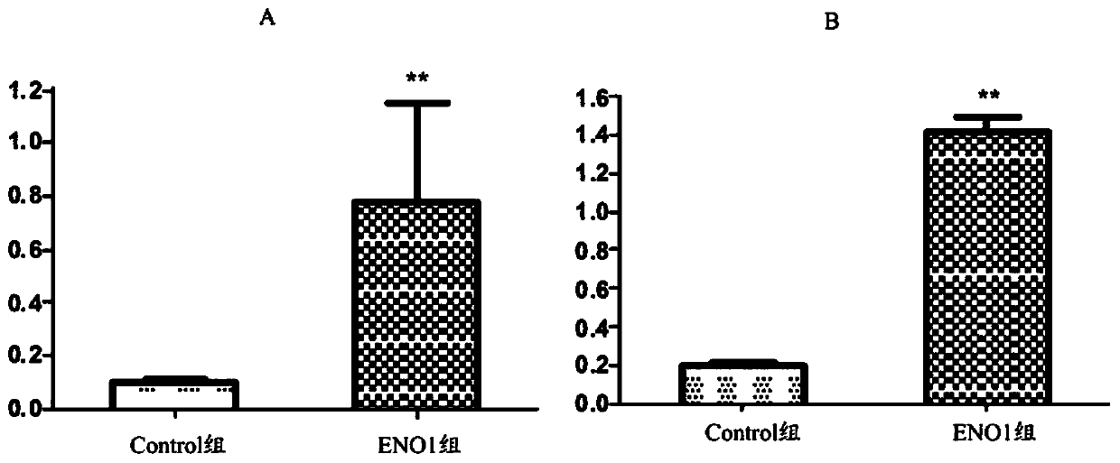 Application of anti-eno1 autoantibodies in screening pregnant women with AIT and predicting the risk of miscarriage