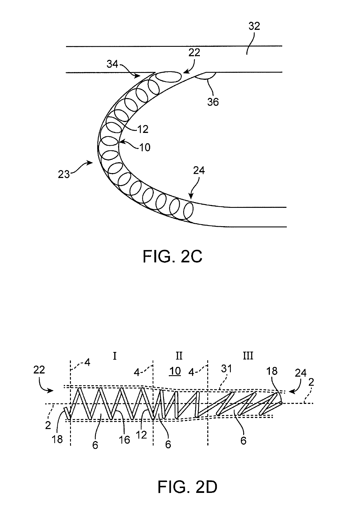 Platform device and method of use to assist in anastomosis formation