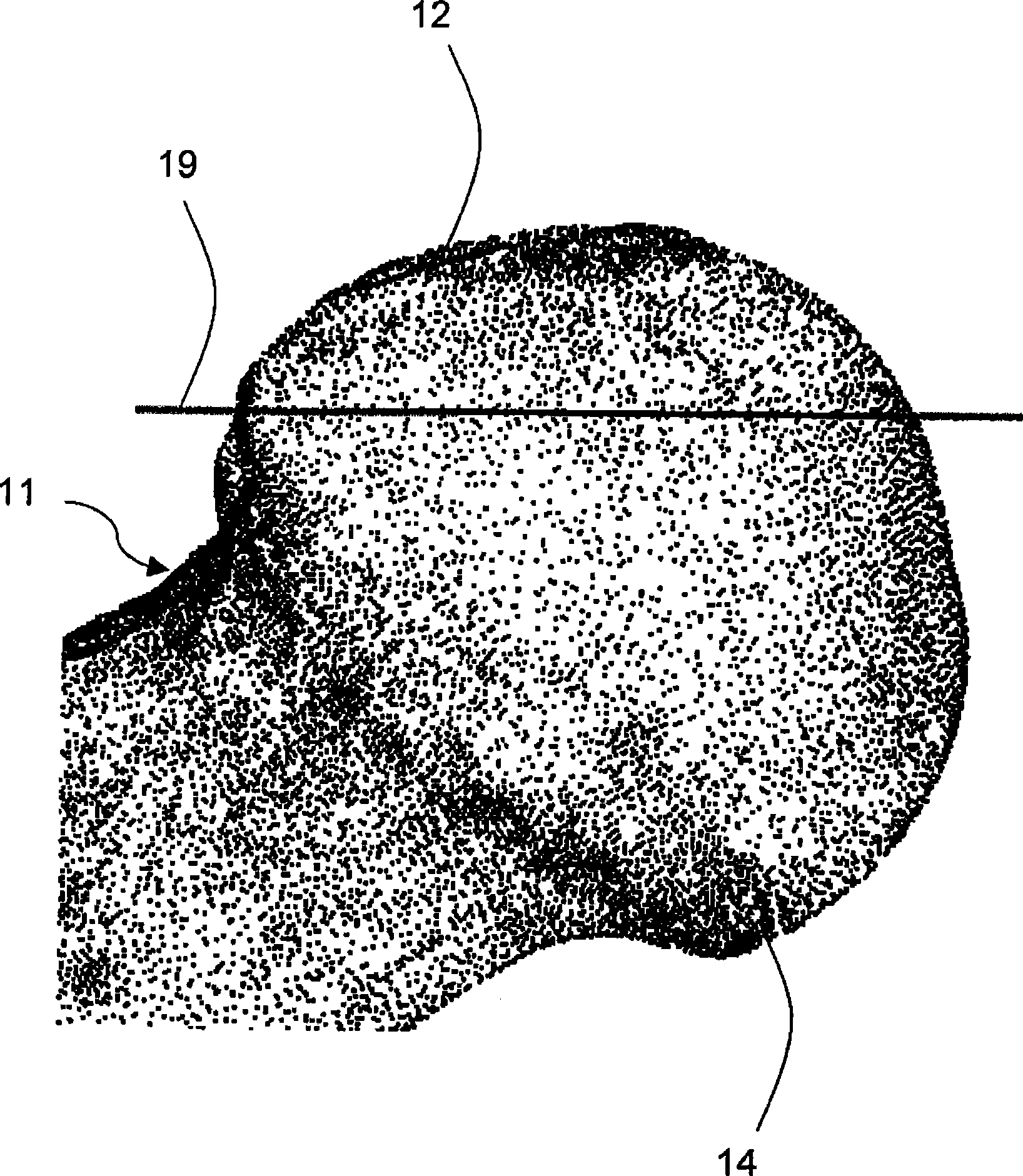 Digital data design method of local joint surface implant