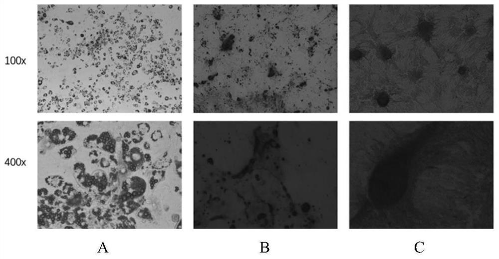 Application of combination of morroniside and stem cells to preparation of cartilage repair materials