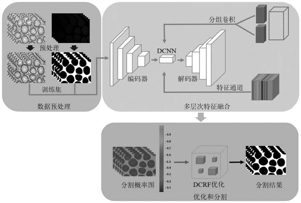 Gland cell segmentation method based on multilevel feature fusion network