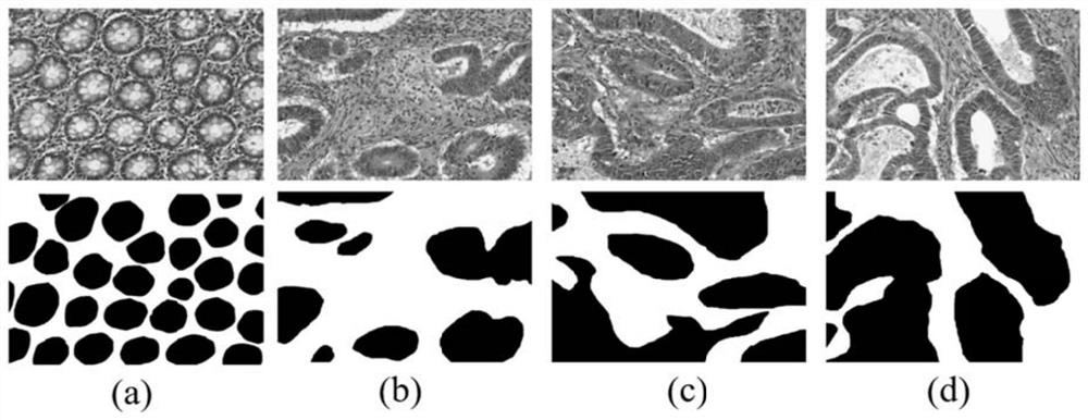 Gland cell segmentation method based on multilevel feature fusion network