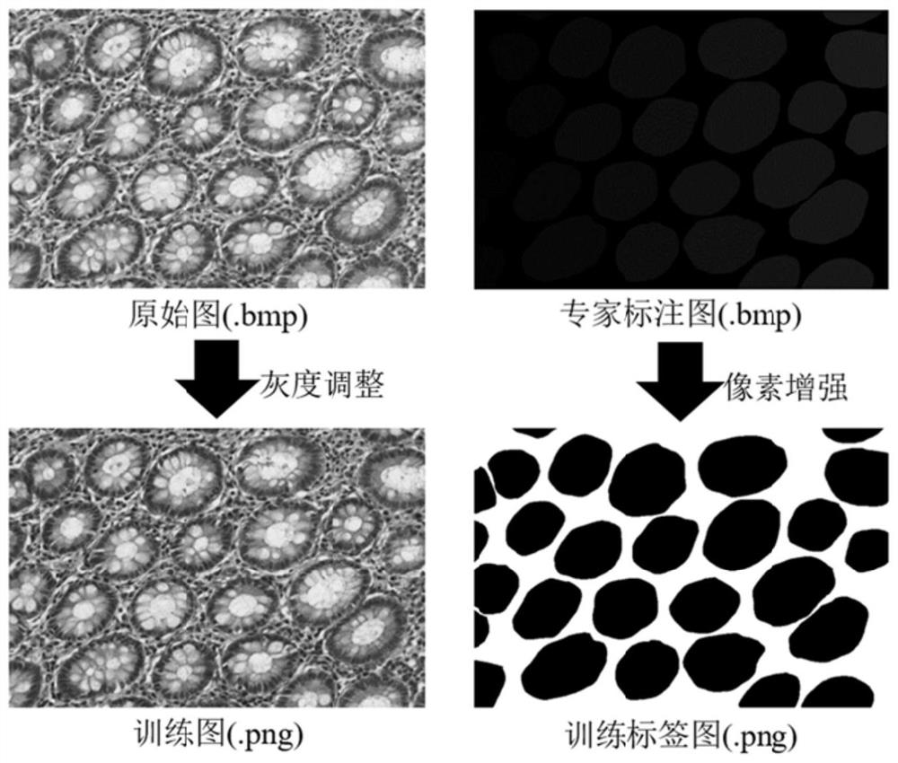 Gland cell segmentation method based on multilevel feature fusion network