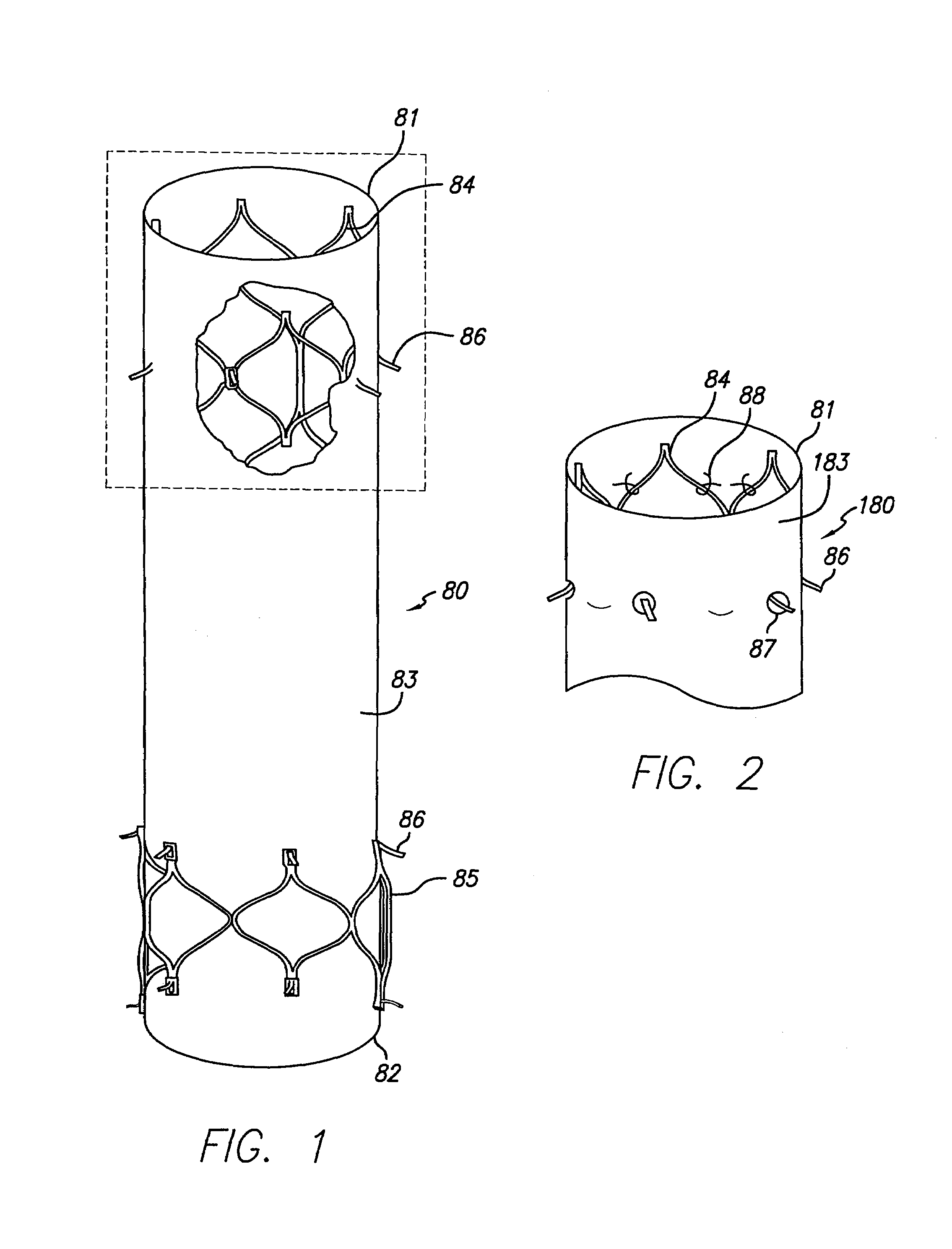 Modular graft component junctions