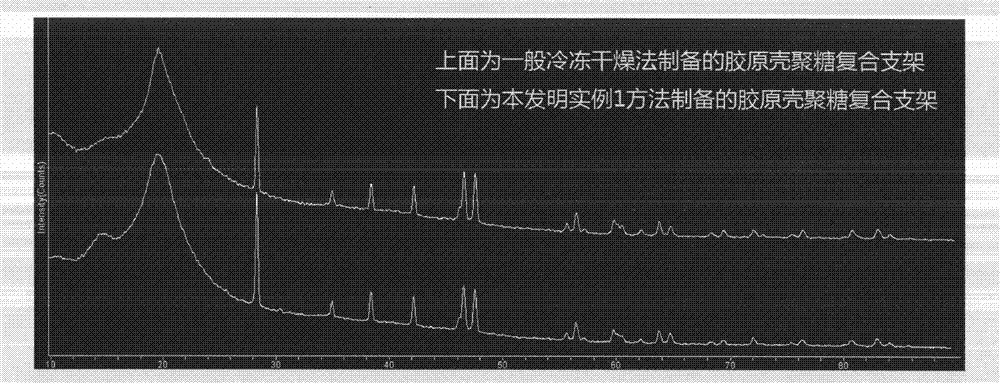 Method for preparing double-layer bionic cartilage tissue engineering scaffold