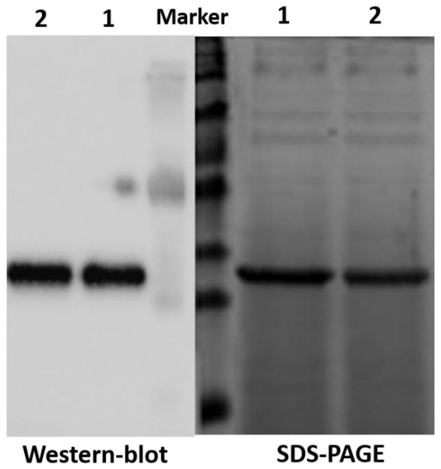 A strain of recombinant Pichia pastoris, its expression product and its application