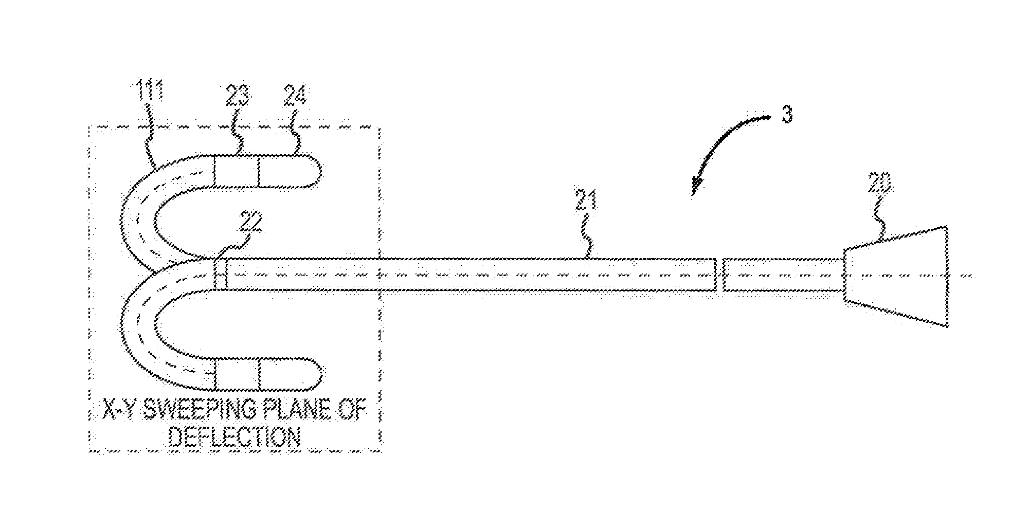 Deflectable Catheter Bodies with Corrugated Tubular Structures