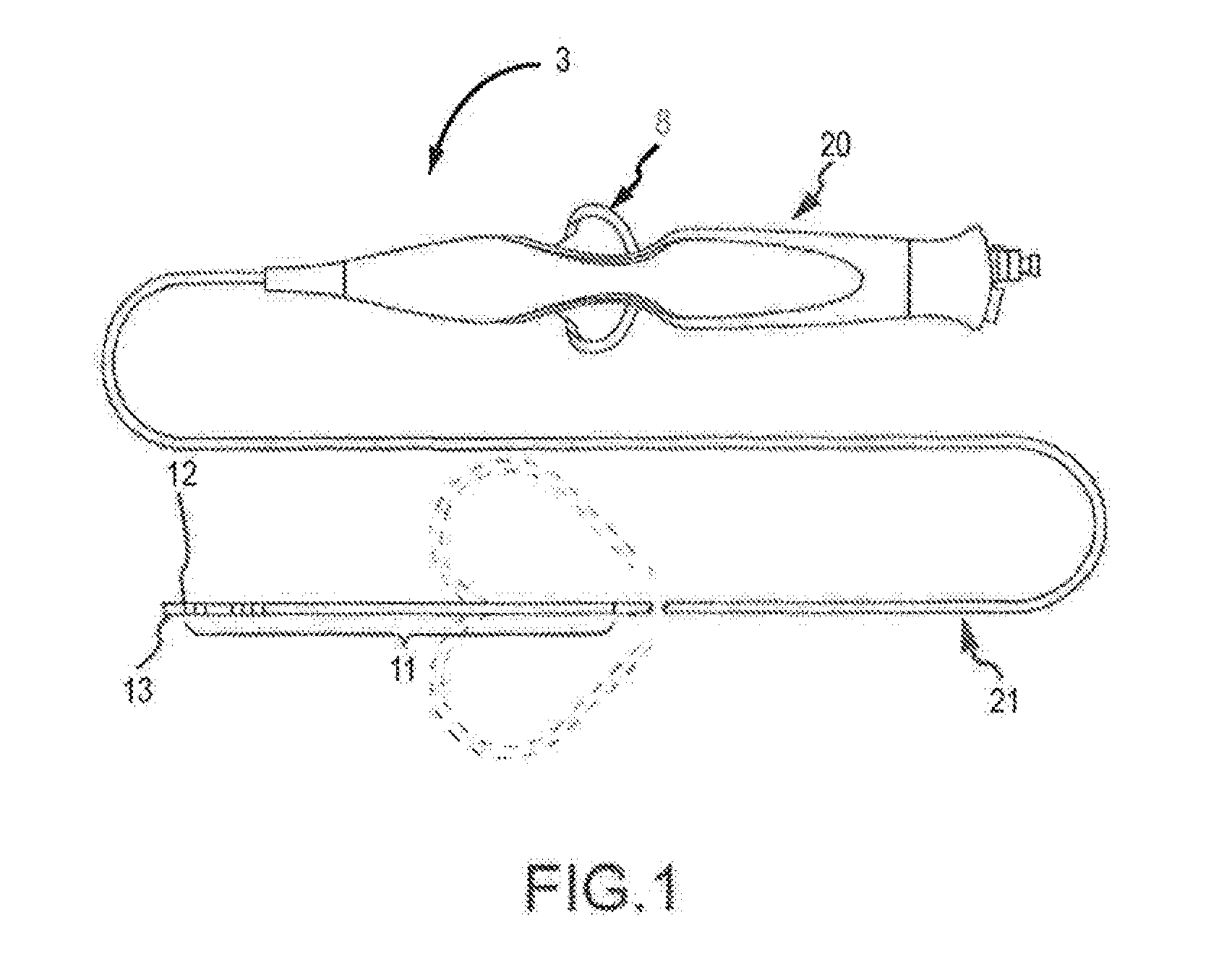 Deflectable Catheter Bodies with Corrugated Tubular Structures