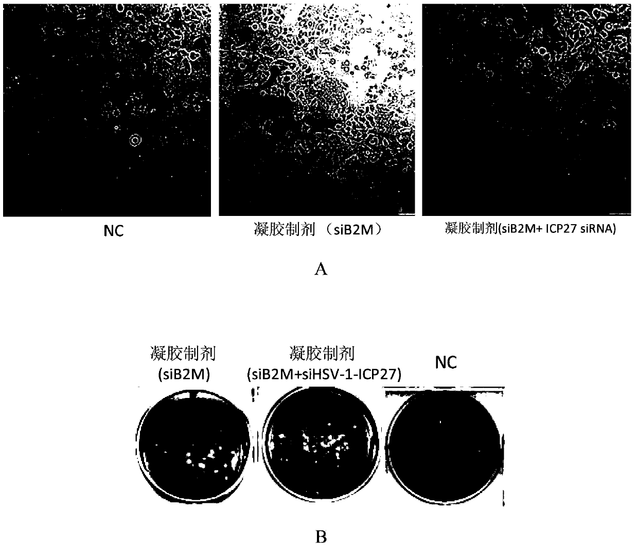 Antiviral small nucleic acid and temperature-sensitive type gel preparation and application thereof