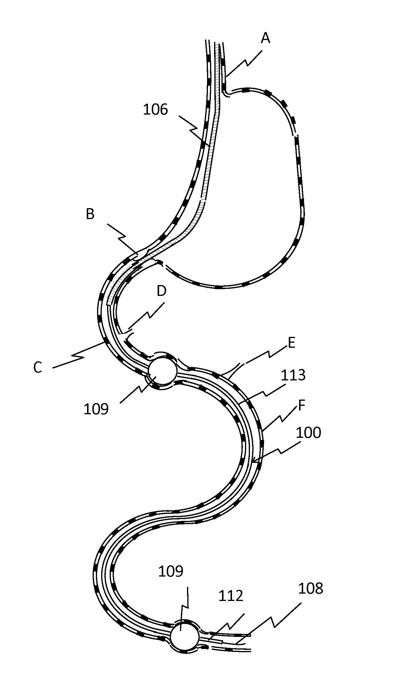 Nutrient Absorption Barrier And Delivery Method