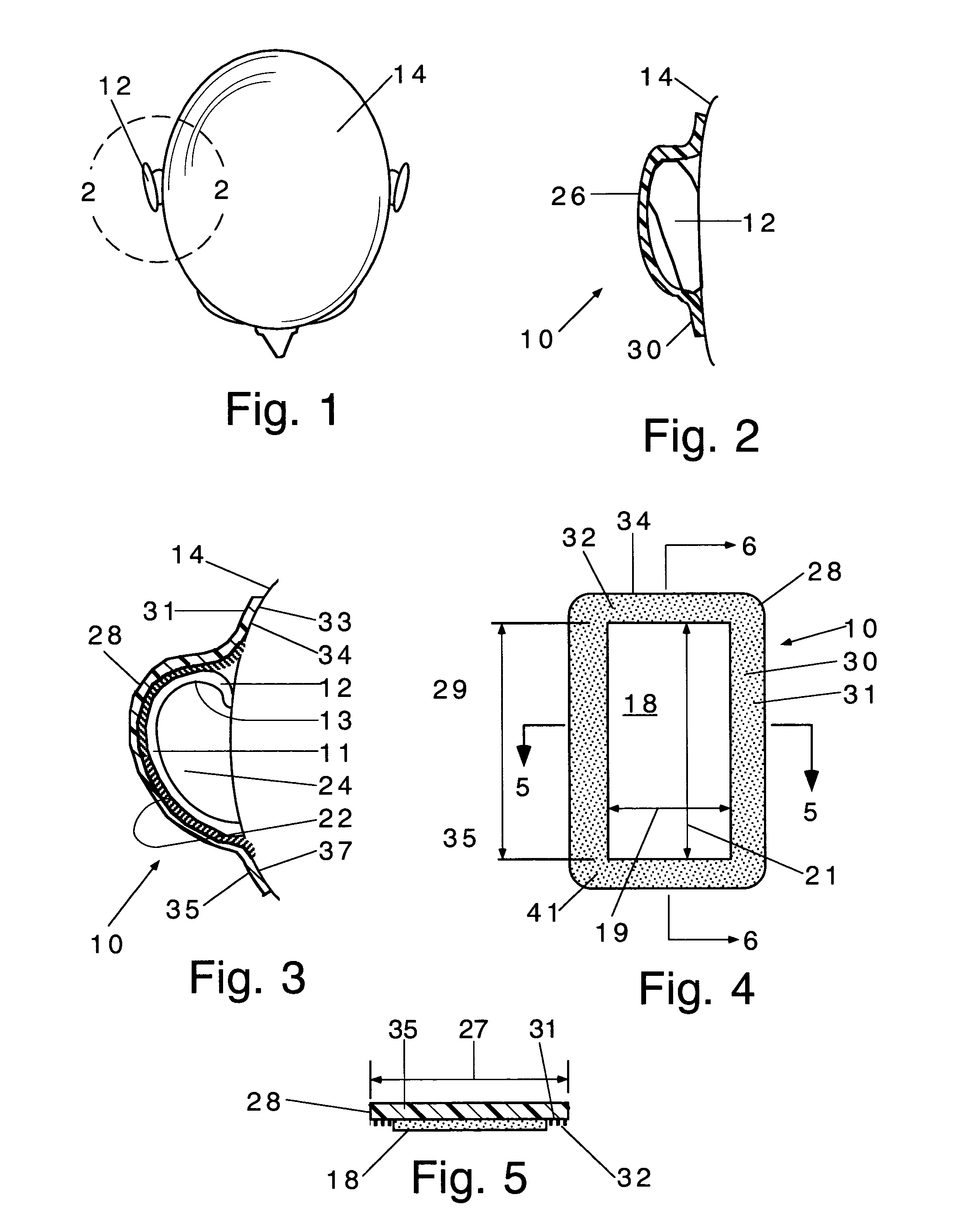 Ear cover and method