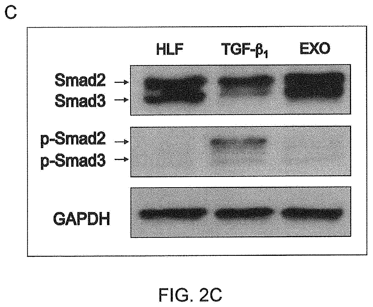 Prevention and treatment of organ fibrosis