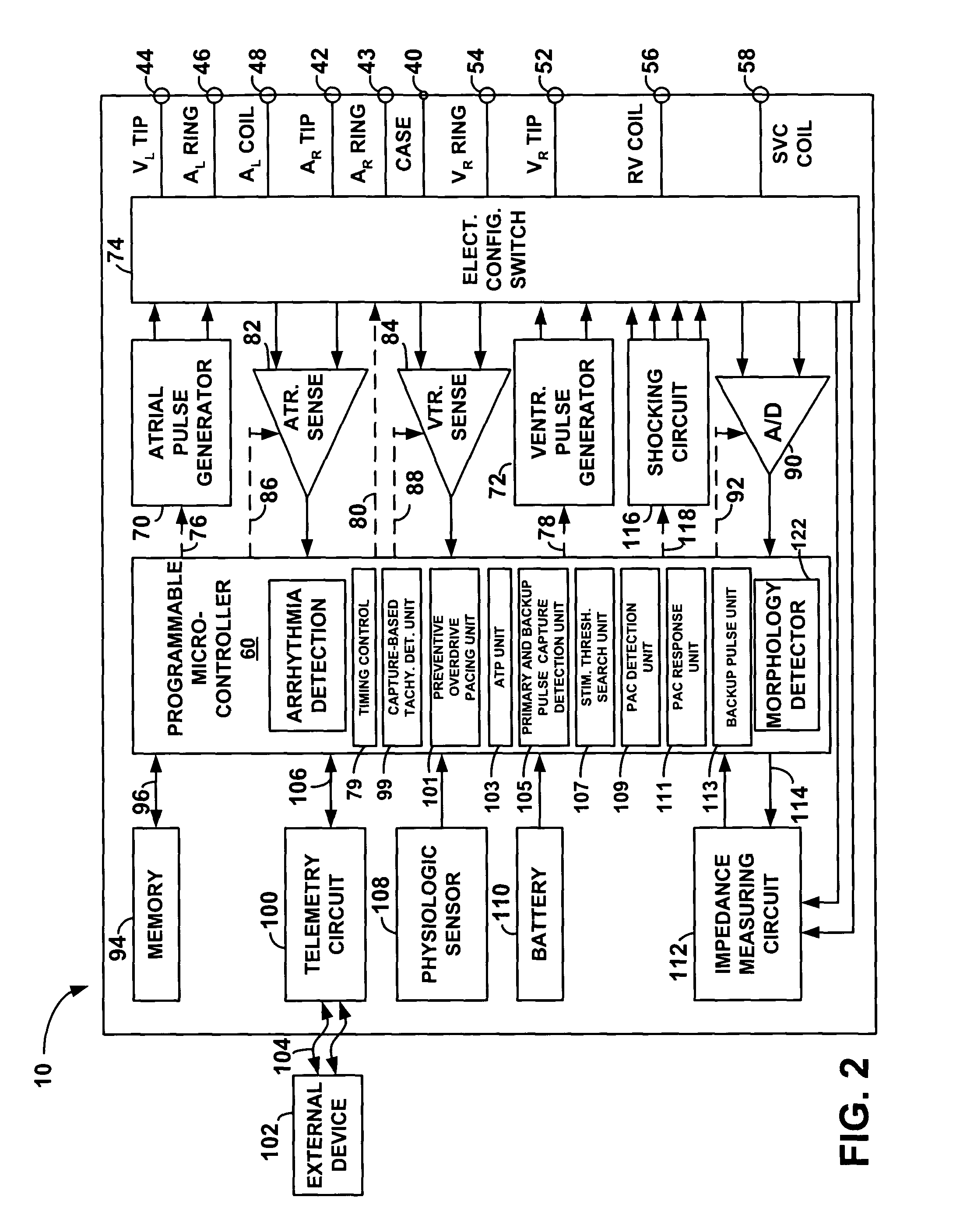 System and method for providing preventive overdrive pacing and antitachycardia pacing using an implantable cardiac stimulation device