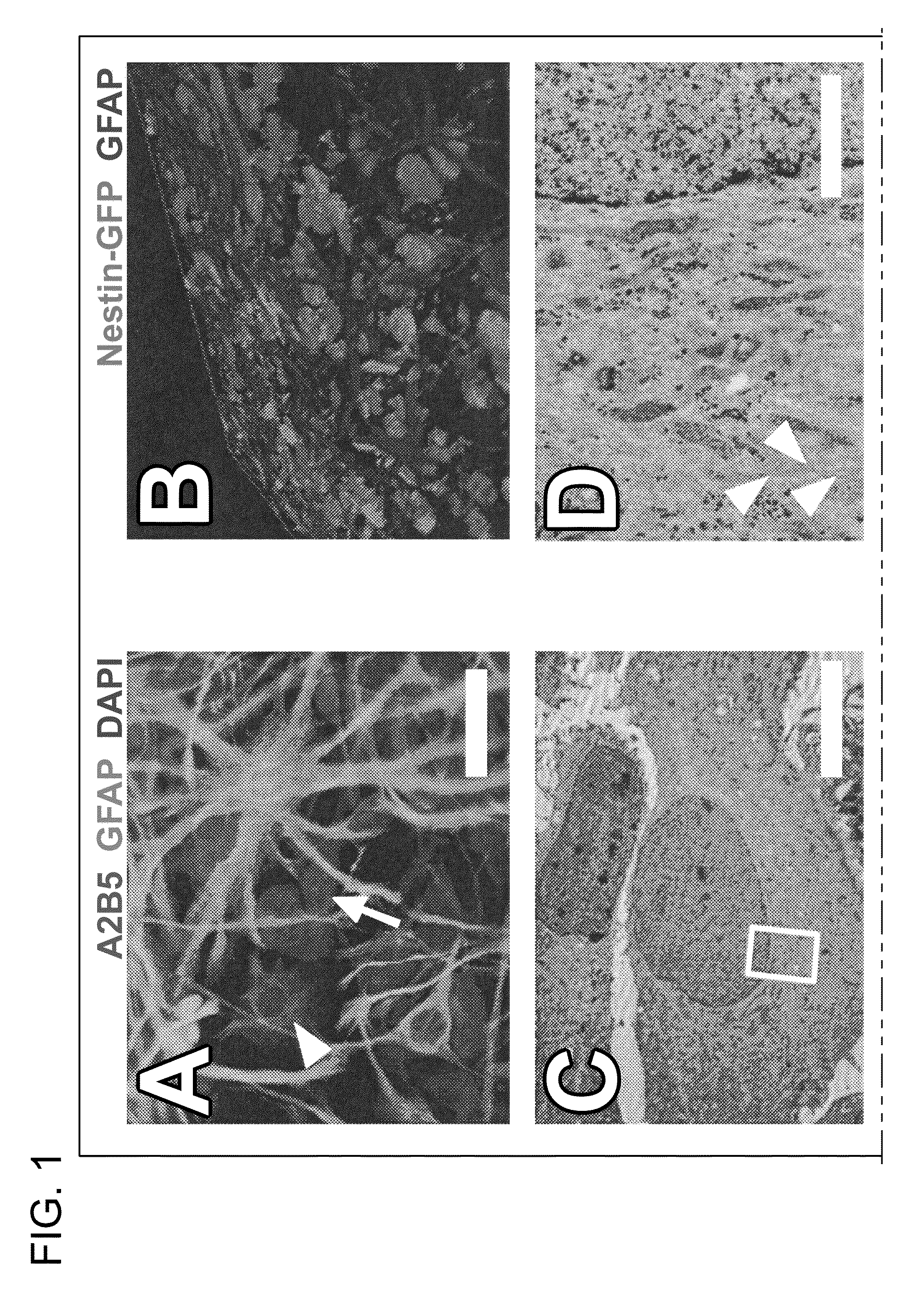 Culturing and differentiating neural precursor cells